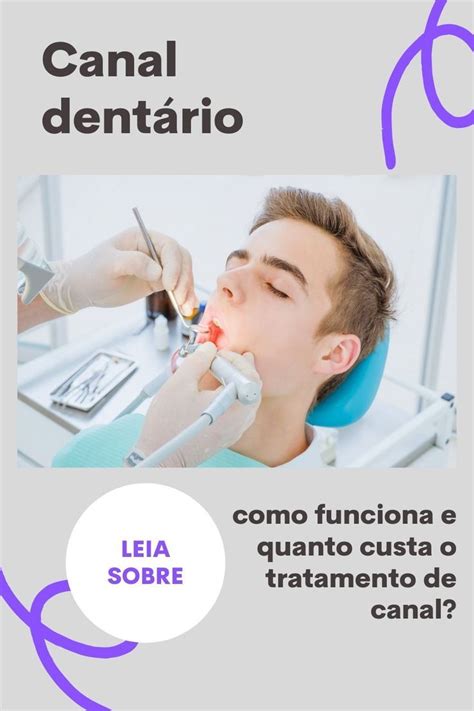 especialidade em canal de dente