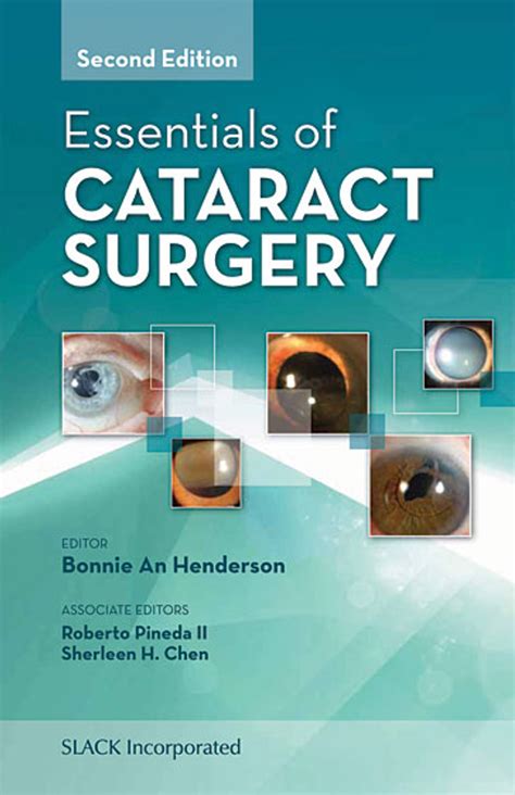 essentials of cataract surgery essentials of cataract surgery Kindle Editon