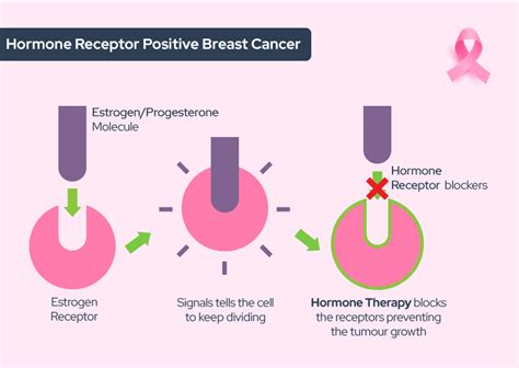estrogen receptor and breast cancer Doc