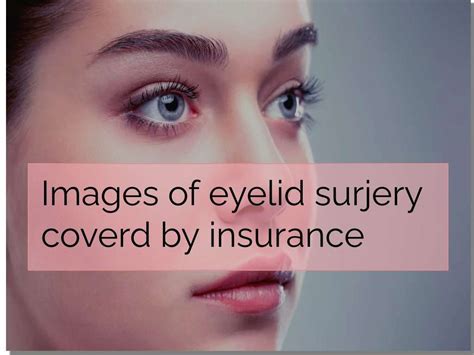 eyelid surgery covered by insurance