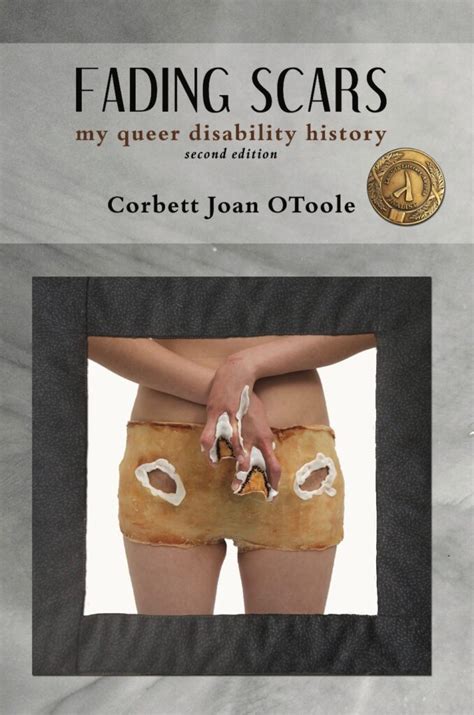 fading scars my queer disability history Kindle Editon
