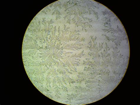 fern test amniotic fluid