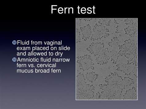 ferning test for amniotic fluid