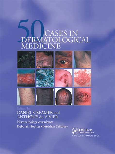 fifty dermatological cases fifty dermatological cases Reader