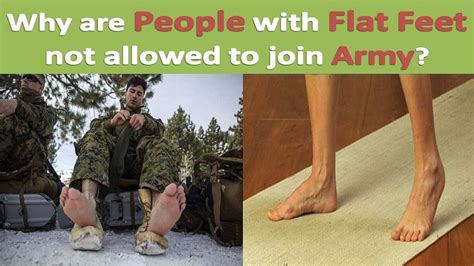 flat foot in army