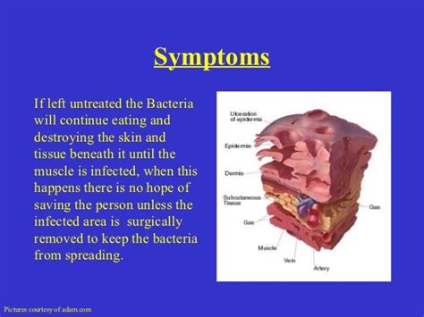 flesh eating bacteria pictures early stages