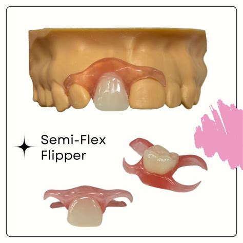 flipper tooth cost without insurance