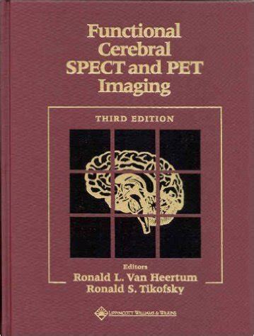 functional cerebral spect and pet imaging Kindle Editon