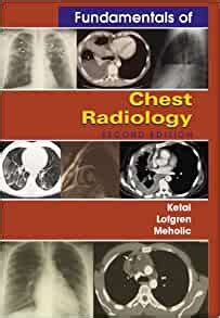 fundamentals of chest radiology 2e fundamentals of radiology Reader