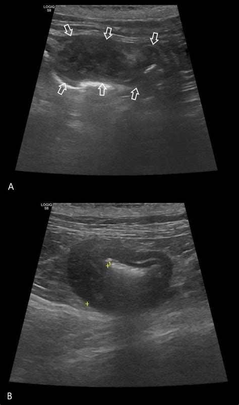 gastric lymphoma in cats