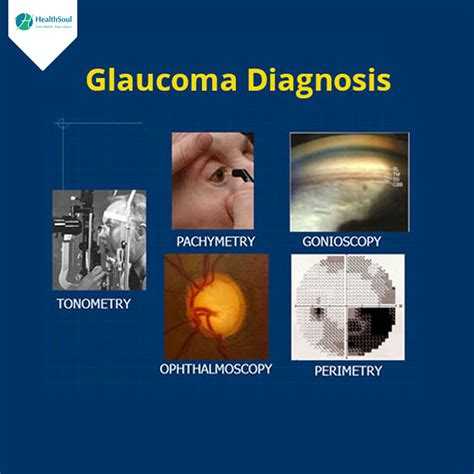 glaucoma diagnosis and management glaucoma diagnosis and management Reader