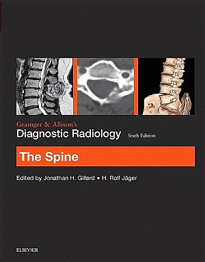 grainger allisons diagnostic radiology spine Epub