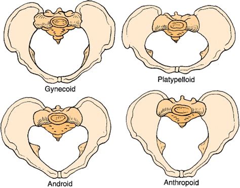 gynecoid hips