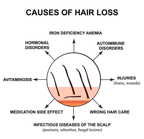 hair growth and disorders hair growth and disorders Doc