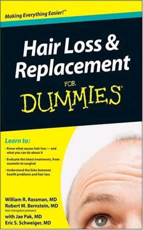 hair loss and replacement for dummies PDF
