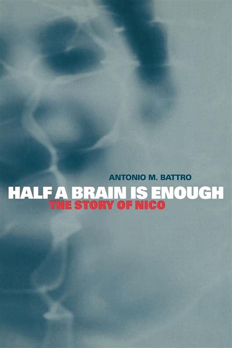 half a brain is enough the story of nico cambridge studies in cognitive and perceptual development Kindle Editon