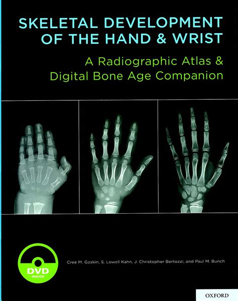 hand bone age a digital atlas of skeletal maturity Epub