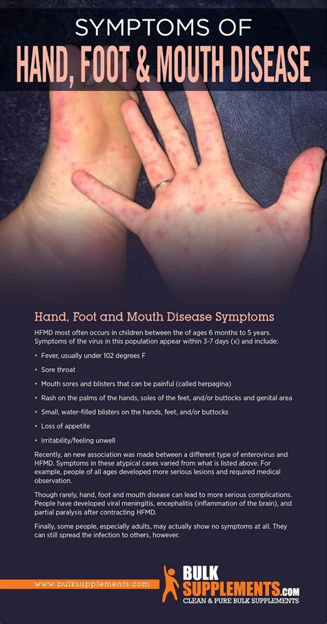 hand foot mouth disease symptoms child