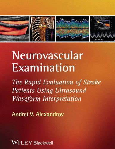 handbook on neurovascular ultrasound Ebook Doc