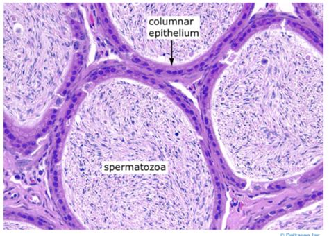 hard epididymis manual guide Doc