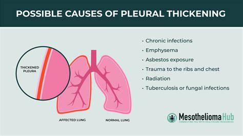 hardening of the lungs