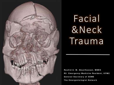 head and neck trauma head and neck trauma Reader