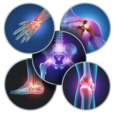 healthy joints life orthopedic inflammation Epub