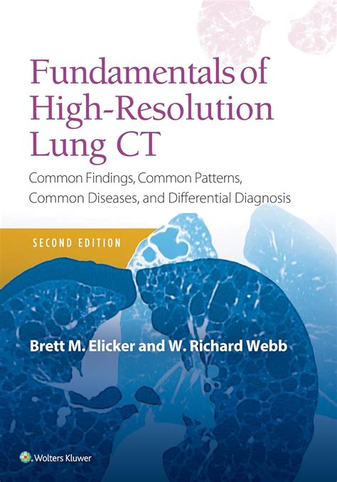 high resolution lung ct cd rom for windows and macintosh PDF