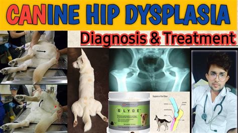 hip dysplasia in dogs treatment