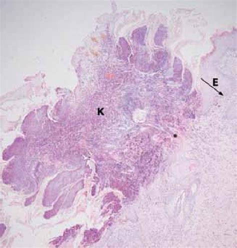 histologisch structuuronderzoek Doc