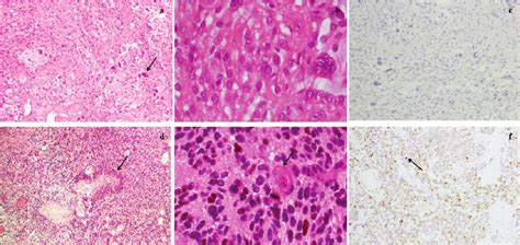 histopathology specimens histopathology specimens Doc