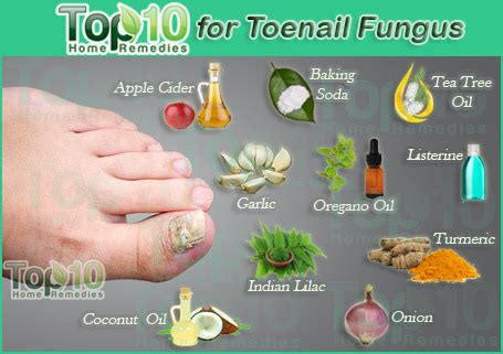 home remedies for fungal foot infection