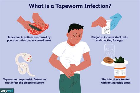 how do i know if i have a tapeworm