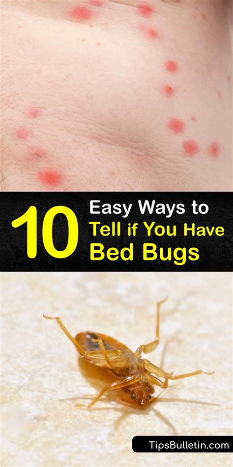 how do u know if u have bed bugs