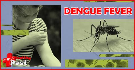 how do you know if you have dengue fever