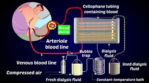 how does a dialysis machine work