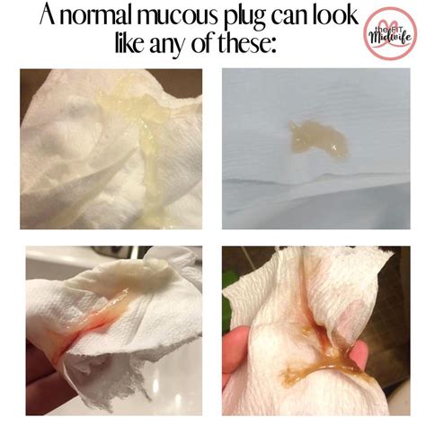 how does mucus plug look like