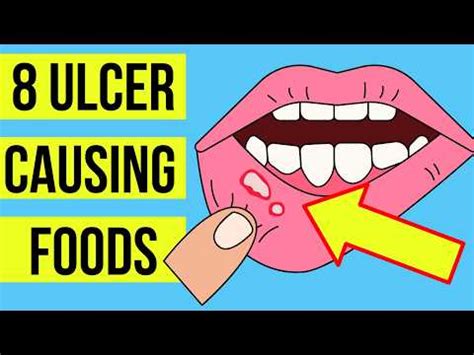 how long do ulcers take to heal