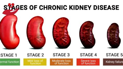 how long does it take to die from kidney failure