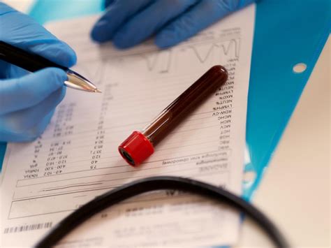 how long for blood test results