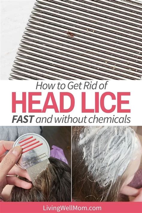 how long to get rid of lice