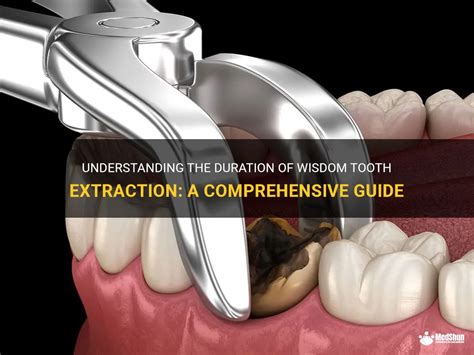 how much is a wisdom tooth extraction