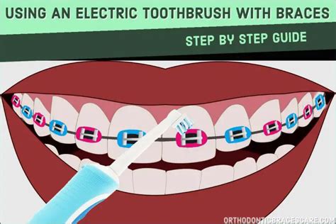 how to brush braces with electric toothbrush