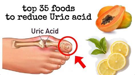 how to cure uric acid permanently