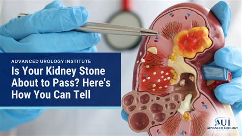 how to detect if you have kidney stones