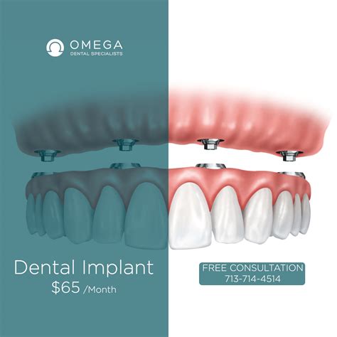 how to get free dental implants