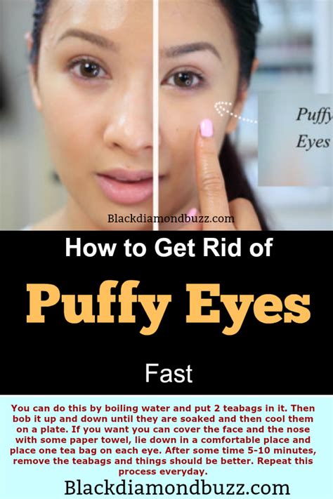 how to get rid of puffy eyes quickly