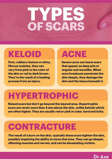 how to get rid of scars