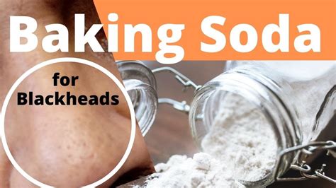 how to remove blackheads on nose with baking soda