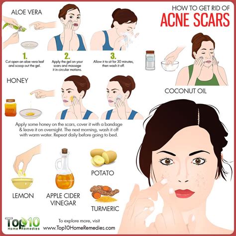 how to remove pimple scars overnight